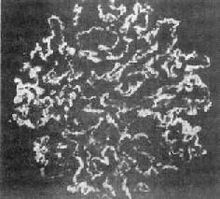 肾小球肾炎 肾小球肾炎