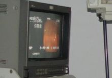 实验室检查 实验室检查